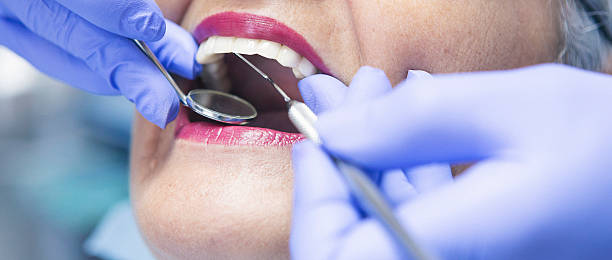 Best Urgent Tooth Repair  in Linden, TX